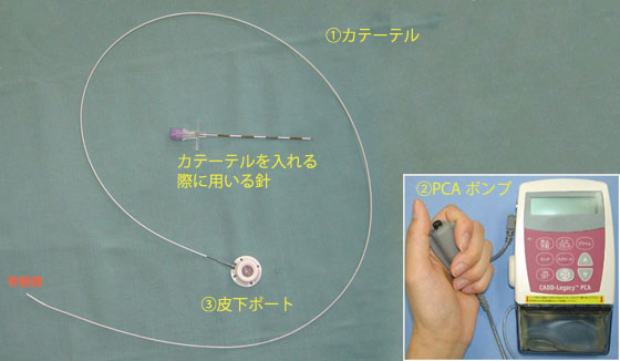 持続くも膜下モルヒネ投与