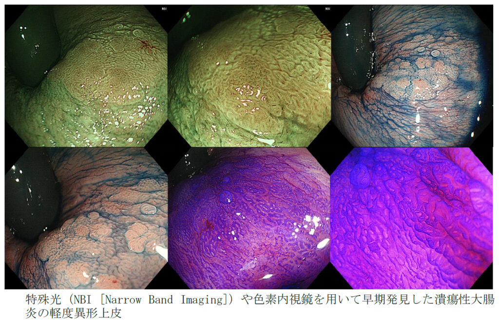 高精度な内視鏡検査