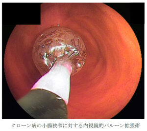 高精度な内視鏡検査