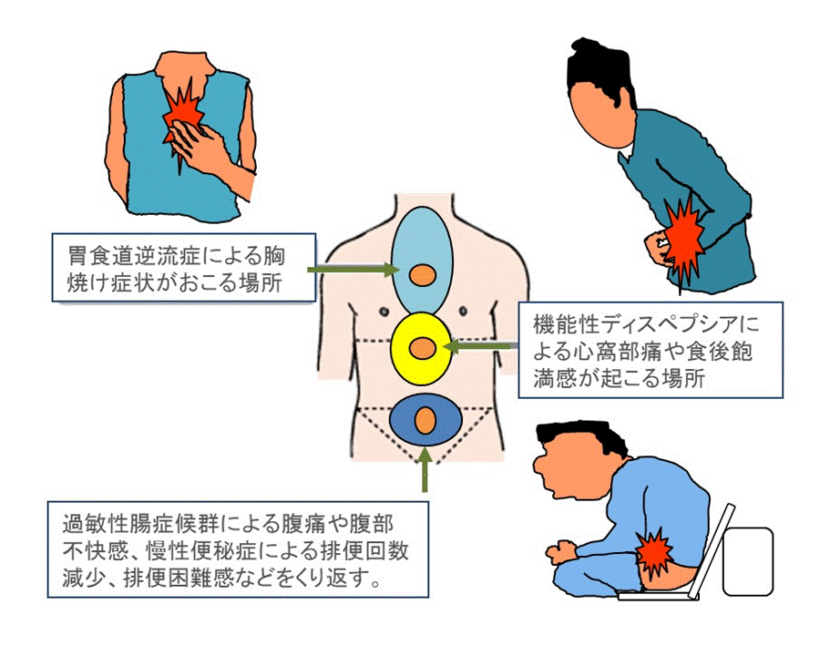 機能性疾患のまとめ