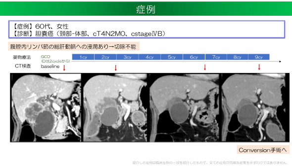 胆膵症例