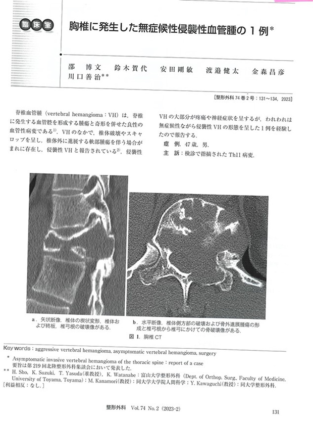 胸椎に発生した無症候性侵襲性血管腫の1例