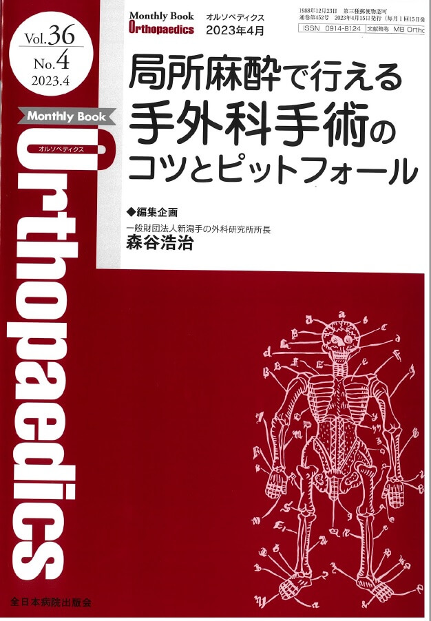 局所麻酔で行える手外科手術のコツとピットフォール