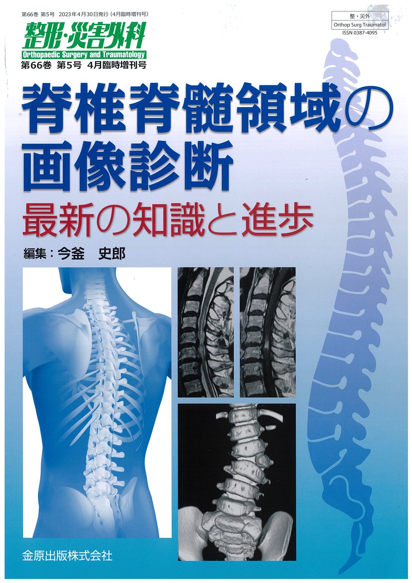 脊椎脊髄領域の画像診断 最新の知識と進歩