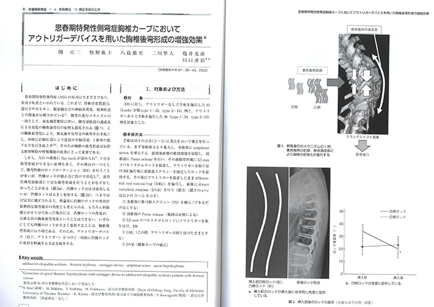 「思春期特発性側弯症胸椎カーブにおいてアウトリガーデバイスを用いた胸椎後弯形成の増強効果」の記事