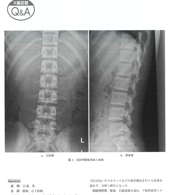 臨床雑誌　整形外科　Vol.76　2025-11　No.12　ｐ1233-4
