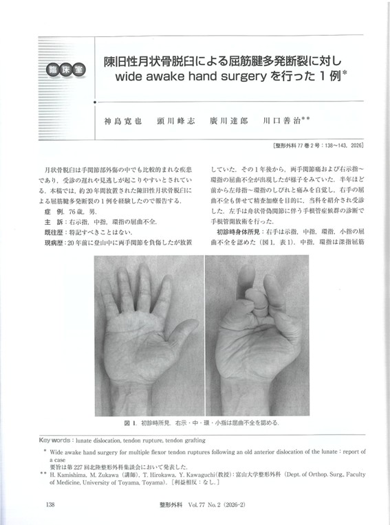 陳旧性月状骨脱臼による屈筋腱多発断裂に対しwide awake hand surgeryを行った1例