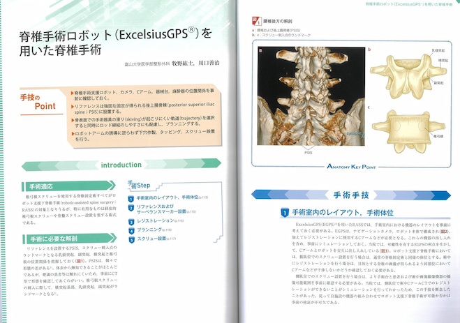 脊椎手術ロボット（ExcelsiusGPS）を用いた脊椎手術