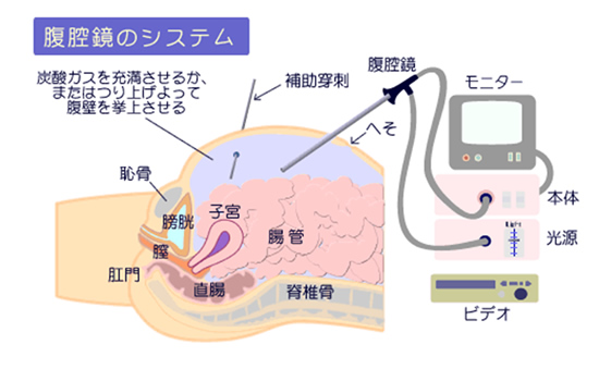 腹腔鏡のシステム